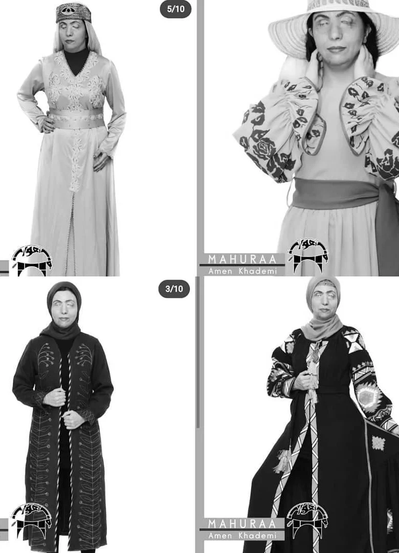 زنان قربانی اسیدپاشی در ایران - مدل لباس شدند